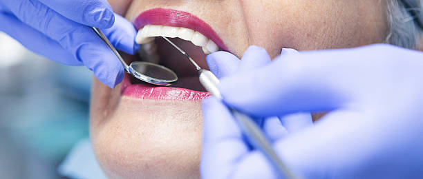 Best Emergency Wisdom Teeth Removal in Washburn, IL
