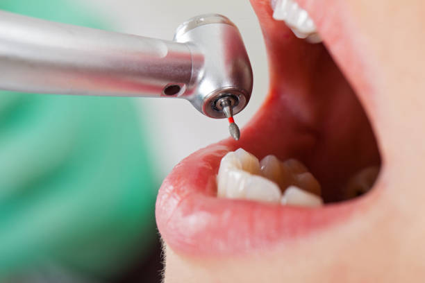 Best Emergency Dental Surgery in Washburn, IL